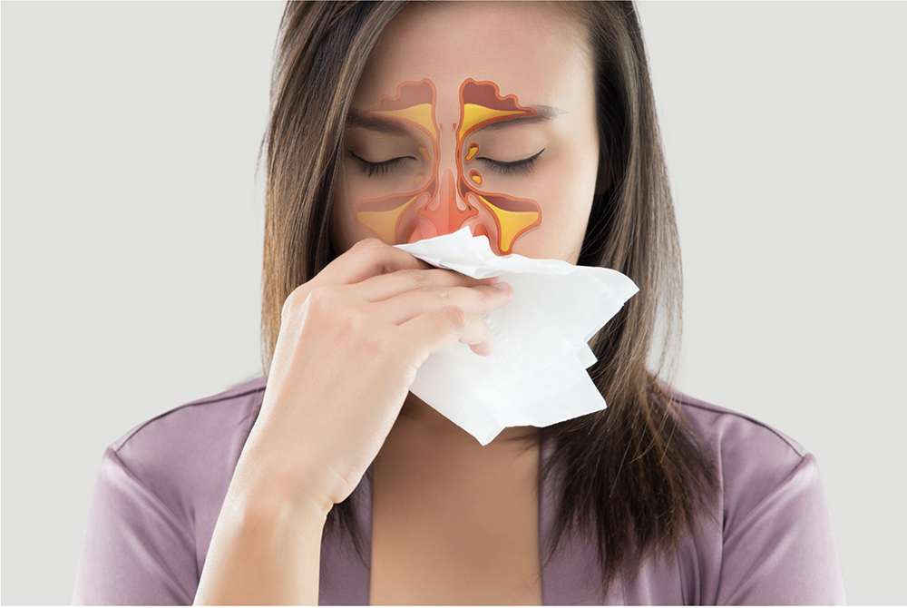Benefits of FESS: Improving Quality of Life for Chronic Sinusitis Patients